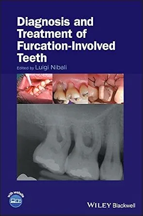خرید و دانلود نسخه کامل کتاب Diagnosis and Treatment of Furcation-Involved Teeth_6a67f1e8f2c27.jpeg خرید و دانلود نسخه کامل کتاب Diagnosis and Treatment of Furcation-Involved Teeth