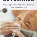 خرید و دانلود نسخه کامل کتاب Toxina Botulínica (Botox): Manual prático de aplicação em terço superior da face (Portuguese Edition)
