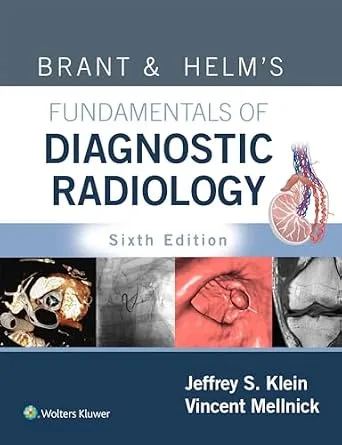 خرید و دانلود نسخه کامل کتاب Brant & Helm’s Fundamentals of Diagnostic Radiology_6a7dc68f67742.jpeg خرید و دانلود نسخه کامل کتاب Brant & Helm’s Fundamentals of Diagnostic Radiology