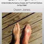 خرید و دانلود نسخه کامل کتاب Gout Management: Understanding The Science, Causes, And Treatment Options For Gout Relief