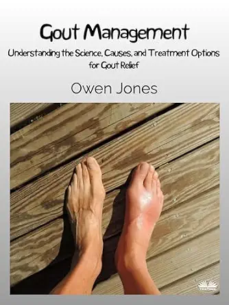 خرید و دانلود نسخه کامل کتاب Gout Management: Understanding The Science, Causes, And Treatment Options For Gout Relief_6a70e7df59fa9.webp خرید و دانلود نسخه کامل کتاب Gout Management: Understanding The Science, Causes, And Treatment Options For Gout Relief