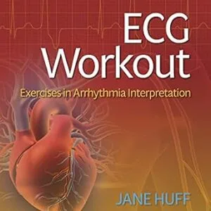 خرید و دانلود نسخه کامل کتاب ECG Workout: Exercises in Arrhythmia Interpretation