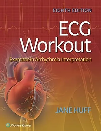 خرید و دانلود نسخه کامل کتاب ECG Workout: Exercises in Arrhythmia Interpretation_6a6cc311b0cde.jpeg خرید و دانلود نسخه کامل کتاب ECG Workout: Exercises in Arrhythmia Interpretation