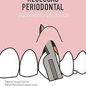 خرید و دانلود نسخه کامل کتاب Recessão Periodontal: Tratamento Cirúrgico (Portuguese Edition)