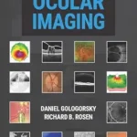 خرید و دانلود نسخه کامل کتاب Principles of Ocular Imaging