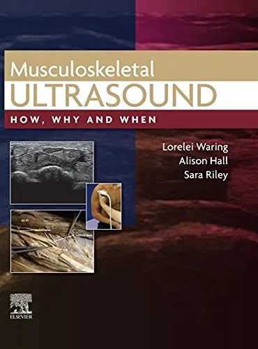 خرید و دانلود نسخه کامل کتاب Musculoskeletal Ultrasound, E-Book: How, Why and When Kindle Edition_6a6fefdabe9c0.jpeg خرید و دانلود نسخه کامل کتاب Musculoskeletal Ultrasound, E-Book: How, Why and When Kindle Edition