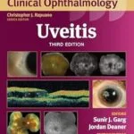 خرید و دانلود نسخه کامل کتاب Uveitis (Wills Eye Institute Atlas Series)