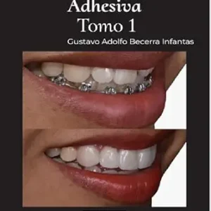 خرید و دانلود نسخه کامل کتاب Odontología estética adhesiva: Tomo 1 (Spanish Edition)