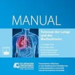 خرید و دانلود نسخه کامل کتاب انگلیسی Tumoren der Lunge und des Mediastinums: Empfehlungen zur Diagnostik, Therapie und Nachsorge (Manuale des Tumorzentrums München) (German Edition)