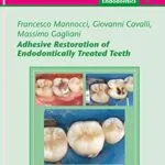 خرید و دانلود نسخه کامل کتاب Adhesive Restoration of Endodontically Treated Teeth: Endodontics 4 (QuintEssentials of Dental Practice Book 40) 1st Edition