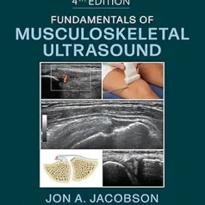 خرید و دانلود نسخه کامل کتاب Fundamentals of Musculoskeletal Ultrasound,E-Book (Fundamentals of Radiology)