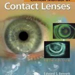 خرید و دانلود نسخه کامل کتاب Clinical Manual of Contact Lenses 5th Edition