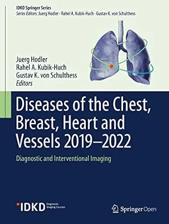 خرید و دانلود نسخه کامل کتاب Diseases of the Chest, Breast, Heart and Vessels 2019-2022: Diagnostic and Interventional Imaging (IDKD Springer Series)_6a6ef81923f8b.jpeg خرید و دانلود نسخه کامل کتاب Diseases of the Chest, Breast, Heart and Vessels 2019-2022: Diagnostic and Interventional Imaging (IDKD Springer Series)