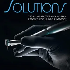 خرید و دانلود نسخه کامل کتاب Solutions: Tecniche restaurative adesive e procedure chirurgiche integrate. Posteriori (Italian Edition) Kindle Edition