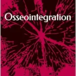 خرید و دانلود نسخه کامل کتاب Osseointegration