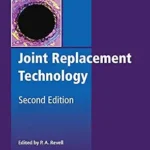 خرید و دانلود نسخه کامل کتاب Joint Replacement Technology (Woodhead Publishing Series in Biomaterials Book 80)