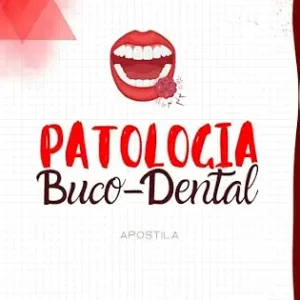 خرید و دانلود نسخه کامل کتاب Patologia Buco-Dental – Odonto Descomplicado: Inclui flashcards, questões e espaço para anotações: tudo o que você precisa para dominar a patologia bucal! (Portuguese Edition)