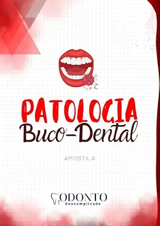 خرید و دانلود نسخه کامل کتاب Patologia Buco-Dental – Odonto Descomplicado: Inclui flashcards, questões e espaço para anotações: tudo o que você precisa para dominar a patologia bucal! (Portuguese Edition)_6a66e5e4ce180.webp خرید و دانلود نسخه کامل کتاب Patologia Buco-Dental – Odonto Descomplicado: Inclui flashcards, questões e espaço para anotações: tudo o que você precisa para dominar a patologia bucal! (Portuguese Edition)