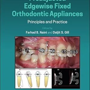 خرید و دانلود نسخه کامل کتاب Preadjusted Edgewise Fixed Orthodontic Appliances: Principles and Practice