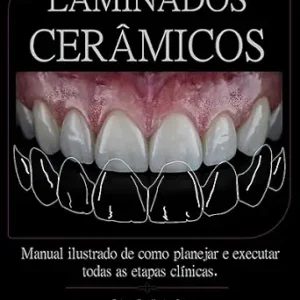 خرید و دانلود نسخه کامل کتاب Laminados Cerâmicos: Manual ilustrado de como planejar e executar todas as etapas clínicas (Portuguese Edition)