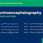خرید و دانلود نسخه کامل کتاب Electroencephalography: Textbook and Atlas