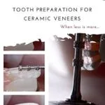 خرید و دانلود نسخه کامل کتاب Tooth preparation for ceramic veneers: When less is more…