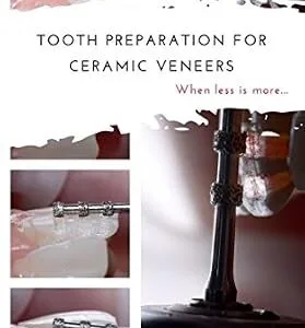 خرید و دانلود نسخه کامل کتاب Tooth preparation for ceramic veneers: When less is more…
