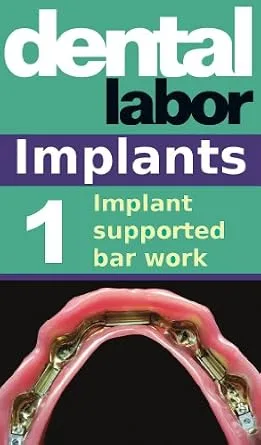 خرید و دانلود نسخه کامل کتاب Implant supported bar work (dental lab technology articles Book 9)_6a685ef52d0e5.jpeg خرید و دانلود نسخه کامل کتاب Implant supported bar work (dental lab technology articles Book 9)