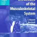 خرید و دانلود نسخه کامل کتاب Ultrasound of the Musculoskeletal System (Medical Radiology) 2007th Edition