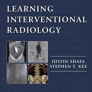خرید و دانلود نسخه کامل کتاب Learning Interventional Radiology eBook 1st Edition