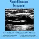 خرید و دانلود نسخه کامل کتاب Carotid Atherosclerotic Plaque Ultrasound Assessment: A Pocket Guide for Ultrasound Practitioners