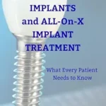 خرید و دانلود نسخه کامل کتاب Dental Implants and ALL-on-X Implant Treatment: What Every Patient Needs to Know