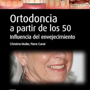 خرید و دانلود نسخه کامل کتاب Ortodoncia a partir de los 50: Influencia del envejecimiento (Spanish Edition)
