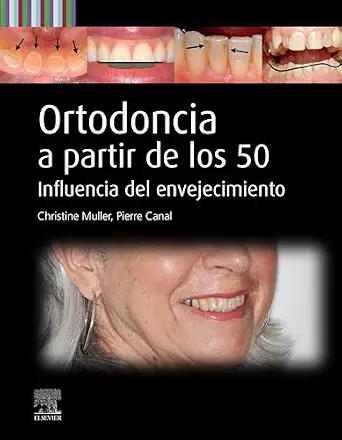 خرید و دانلود نسخه کامل کتاب Ortodoncia a partir de los 50: Influencia del envejecimiento (Spanish Edition)_6a66ead1421a5.webp خرید و دانلود نسخه کامل کتاب Ortodoncia a partir de los 50: Influencia del envejecimiento (Spanish Edition)