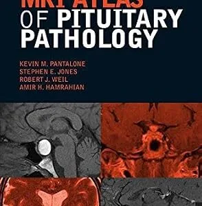 خرید و دانلود نسخه کامل کتاب MRI Atlas of Pituitary Pathology