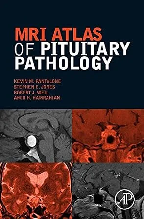 خرید و دانلود نسخه کامل کتاب MRI Atlas of Pituitary Pathology_6a7bb2c1eb197.jpeg خرید و دانلود نسخه کامل کتاب MRI Atlas of Pituitary Pathology