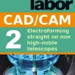 خرید و دانلود نسخه کامل کتاب Electroforming straight on non high-noble telescopes (dental lab technology articles Book 4) Kindle Edition