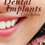 خرید و دانلود نسخه کامل کتاب Dental Implants Columbus