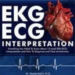 خرید و دانلود نسخه کامل کتاب EKG/ECG Interpretation: Everything you Need to Know about the 12 – Lead ECG/EKG Interpretation and How to Diagnose and Treat Arrhythmias: 2nd Edition Kindle Edition