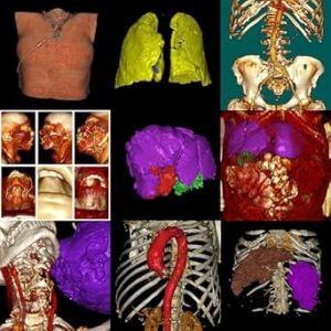 خرید و دانلود نسخه کامل کتاب “Inteligencia Artificial en Radiología: Avances Revolucionarios para Profesionales de la Salud” (Spanish Edition)