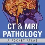 خرید و دانلود نسخه کامل کتاب CT & MRI Pathology: A Pocket Atlas, Third Edition 3rd Edition