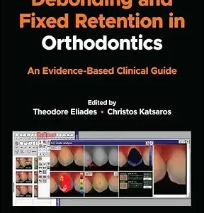 خرید و دانلود نسخه کامل کتاب Debonding and Fixed Retention in Orthodontics: An Evidence-Based Clinical Guide