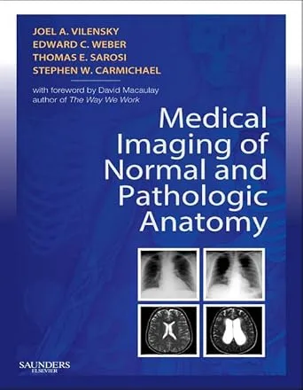 خرید و دانلود نسخه کامل کتاب Medical Imaging of Normal and Pathologic Anatomy: Medical Imaging of Normal and Pathologic Anatomy E-Book_6a7017f83c20e.jpeg خرید و دانلود نسخه کامل کتاب Medical Imaging of Normal and Pathologic Anatomy: Medical Imaging of Normal and Pathologic Anatomy E-Book