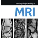 خرید و دانلود نسخه کامل کتاب Planning and Positioning in MRI – E-Book 1st Edition