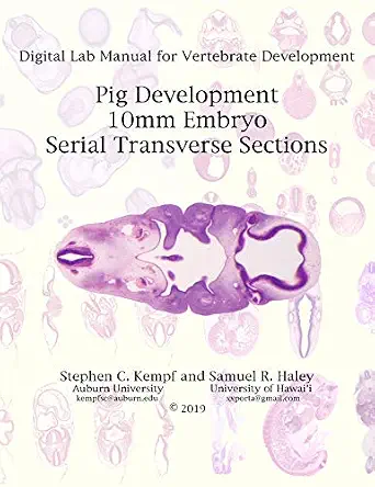 خرید و دانلود نسخه کامل کتاب 10mm Pig Embryo Serial Transverse Sections: Digital Lab Manual for Vertebrate Development_6a79c1046866d.webp خرید و دانلود نسخه کامل کتاب 10mm Pig Embryo Serial Transverse Sections: Digital Lab Manual for Vertebrate Development