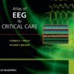خرید و دانلود نسخه کامل کتاب Atlas of EEG in Critical Care 1st Edition