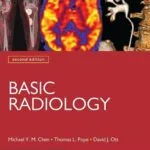 خرید و دانلود نسخه کامل کتاب Basic Radiology, Second Edition (LANGE Clinical Medicine)