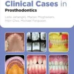 خرید و دانلود نسخه کامل کتاب Clinical Cases in Prosthodontics (Clinical Cases (Dentistry) Book 9)