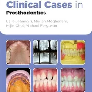 خرید و دانلود نسخه کامل کتاب Clinical Cases in Prosthodontics (Clinical Cases (Dentistry) Book 9)
