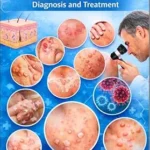 خرید و دانلود نسخه کامل کتاب Dermatology: A Comprehensive Guide to Diagnosis and Treatment (Medical Study Books By Sanjay Mandavi Book 3)